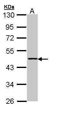 Aminoacylase 1 Rabbit Polyclonal Antibody