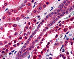 Goat anti-Amisyn / STXBP6 Antibody