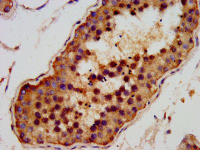 AMMECR1 antibody