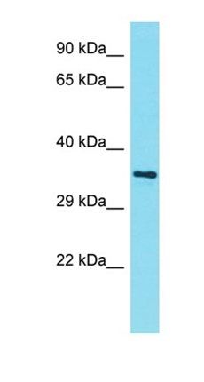AMMECR1L antibody
