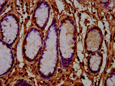 AMN Antibody