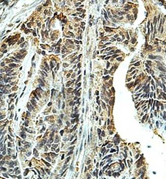 AMN1 Rabbit Polyclonal Antibody