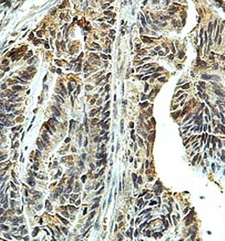 AMN1 antibody