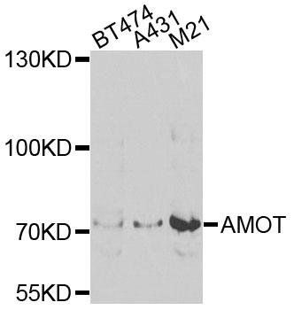 AMOT antibody