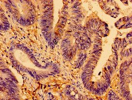 AMPD2 Antibody