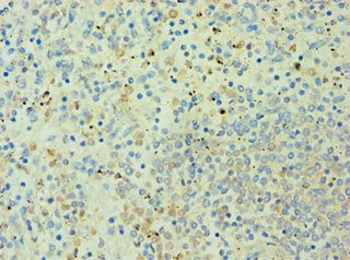 AMPD3 antibody