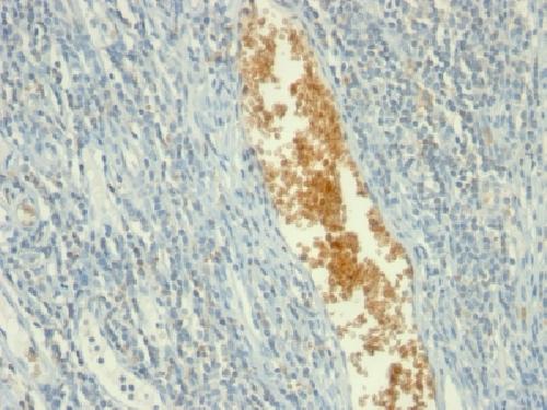 AMPD3 Antibody