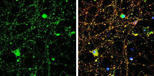 Amphiphysin antibody [N1N2], N-term