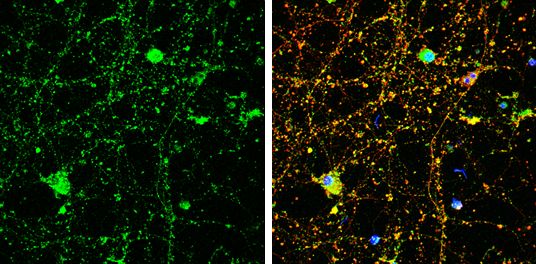 Amphiphysin antibody