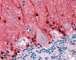 Goat anti-Amphiphysin / AMPH Antibody
