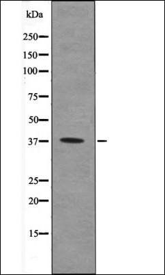 PRKAB1 (Phospho-Ser181) antibody