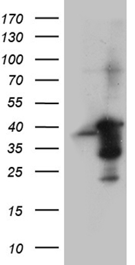 AMPK beta 1 Antibody