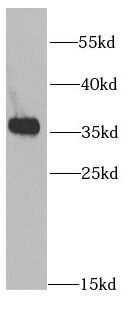 AMPK beta 2 antibody
