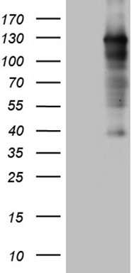 AMPK beta 2 (PRKAB2) antibody