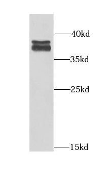 AMPK gamma 1 antibody