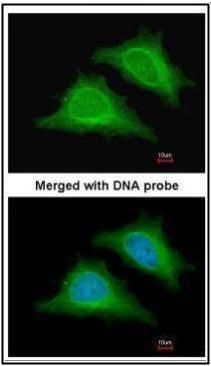 AMPK gamma 2 Rabbit Polyclonal Antibody
