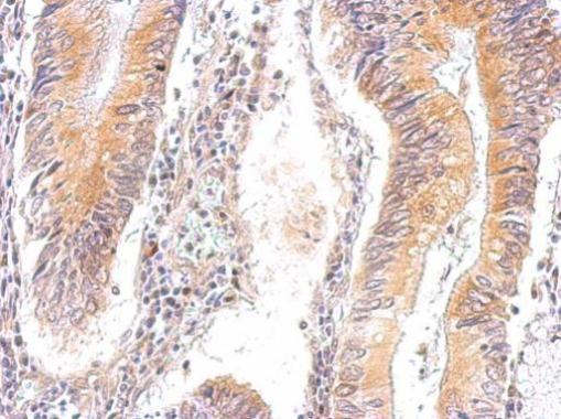 AMPK gamma 2 Rabbit Polyclonal Antibody