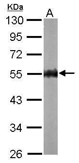 AMPK gamma 2 Rabbit Polyclonal Antibody