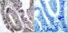 AMPKα1 (Phospho-Ser496)Antibody