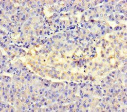 AMTN Antibody