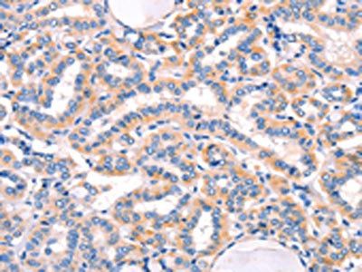 AMY2A Antibody