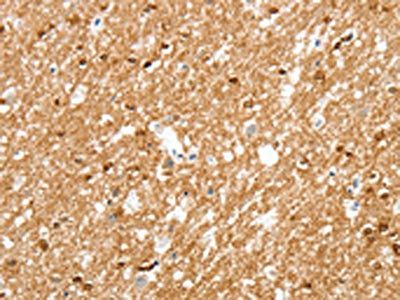 AMZ1 antibody