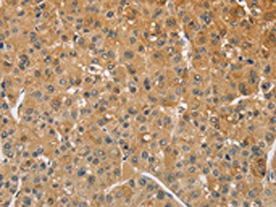 AMZ2 Antibody