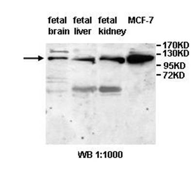 ANAPC2 Rabbit Polyclonal Antibody