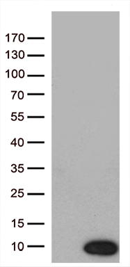 Androgen Receptor (AR) antibody