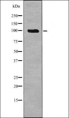 Androgen Receptor (Phospho-Ser308) antibody