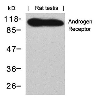Androgen Receptor (Ab-650) Antibody