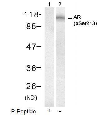 Androgen Receptor (Phospho-Ser213) Antibody