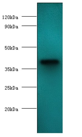 anemia virus apoptin antibody (Biotin)