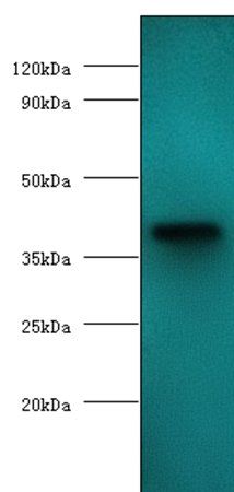 anemia virus apoptin antibody