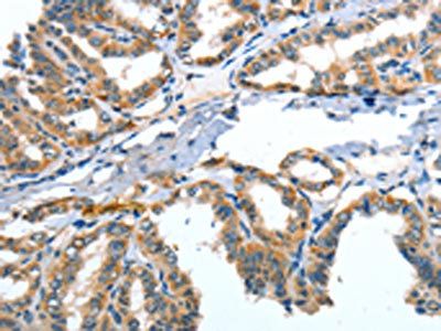 Angiopoietin 2 antibody