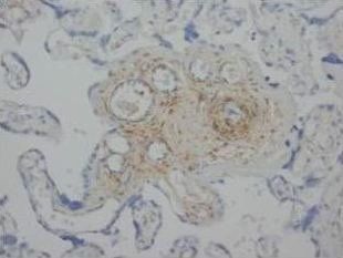 Anti-Angiopoietin 2/ANGPT2 Antibody