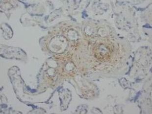 Angiopoietin 2/ANGPT2 Antibody