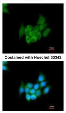 Angiotensin II antibody