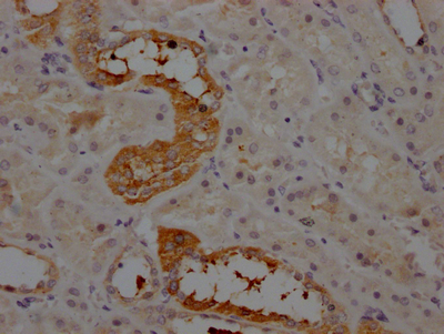 Angiotensin II antibody