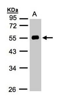 Angiotensin antibody
