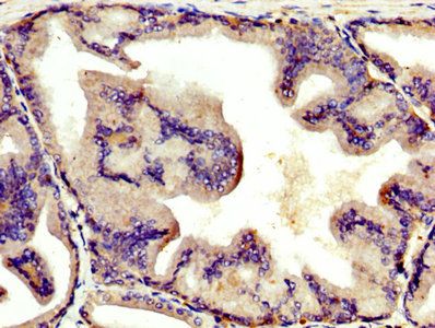 Angiotensinogen antibody