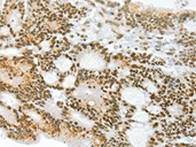 ANGPT4 Antibody