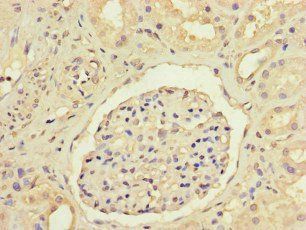 ANGPTL1 Antibody