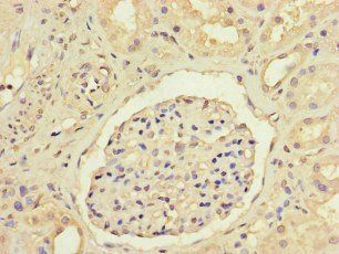 ANGPTL1 antibody