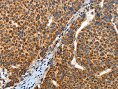ANGPTL1 Antibody
