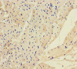 ANGPTL2 Antibody