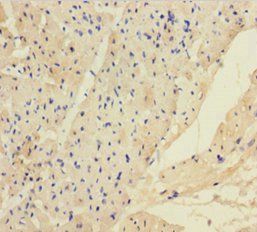 Angiopoietin 2 antibody