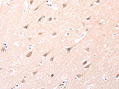 ANGPTL2 Antibody