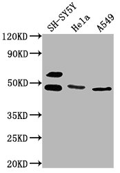 ANGPTL4 antibody