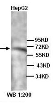 ANGPTL6 Rabbit Polyclonal Antibody
